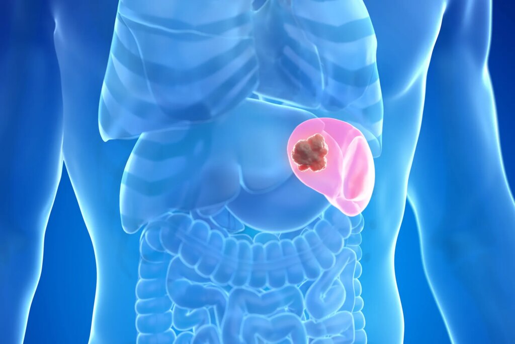 When does splenomegaly become a sign of a serious illness?