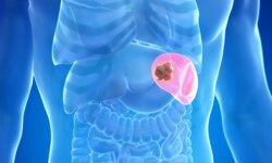 When does splenomegaly become a sign of a serious illness?