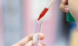 Symptoms disappear and then return.. Why do parasitic infections recur after treatment?