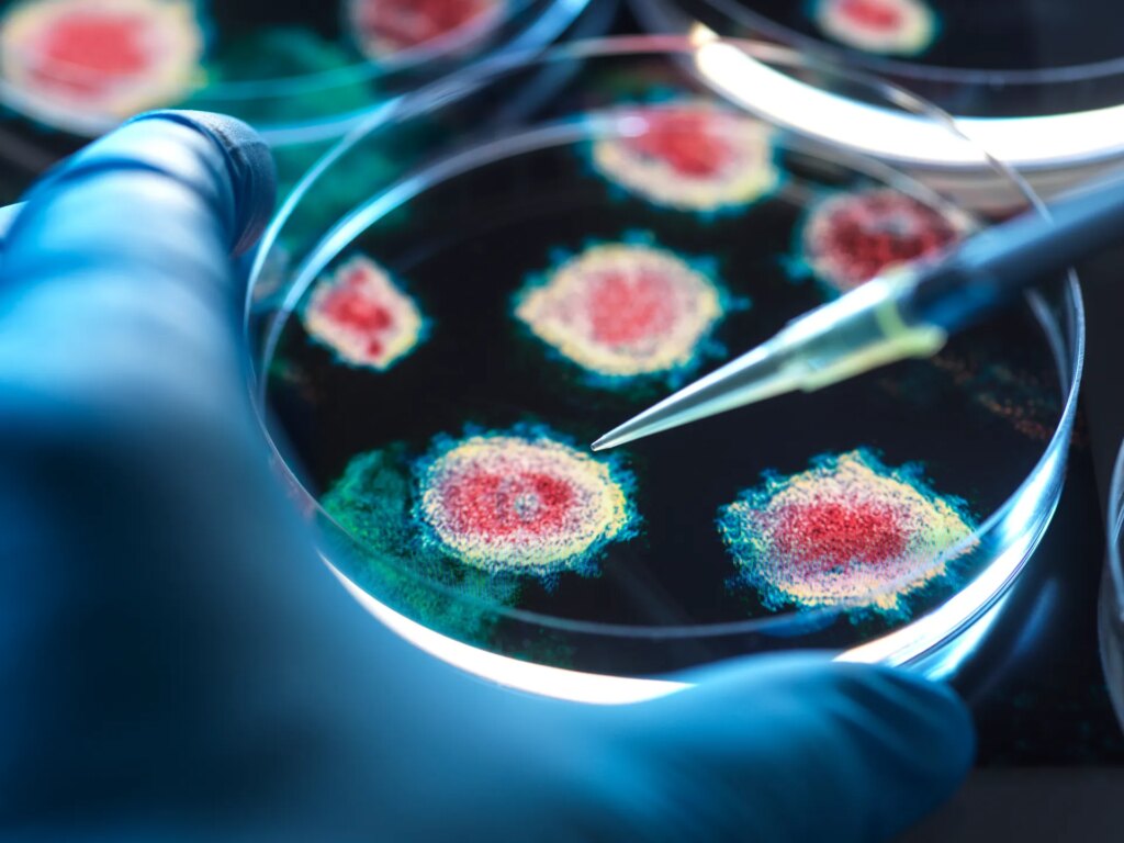 A woman dies of plague in Siberia and dozens are under quarantine