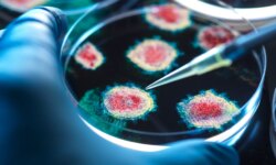 A woman dies of plague in Siberia and dozens are under quarantine