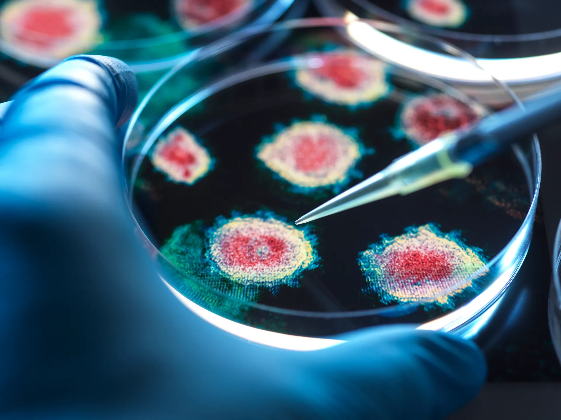 A woman dies of plague in Siberia and dozens are under quarantine