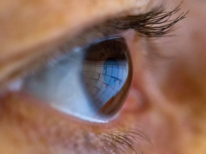 Fluctuations in visual acuity during the day, such as blurry vision in the morning and clear vision in the afternoon, indicate diabetes. It is mostly due to fluctuations in blood sugar levels. (Publication is free for clients of the German News Agency “dpa”. The image may only be used with the aforementioned text and provided that its source is indicated.) Lens: dpa
